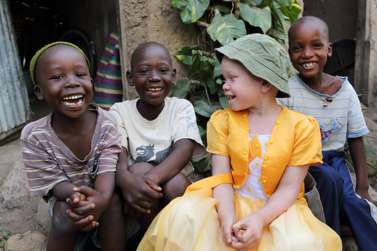 How the media can help protect people with albinism. A Tanzanian case study