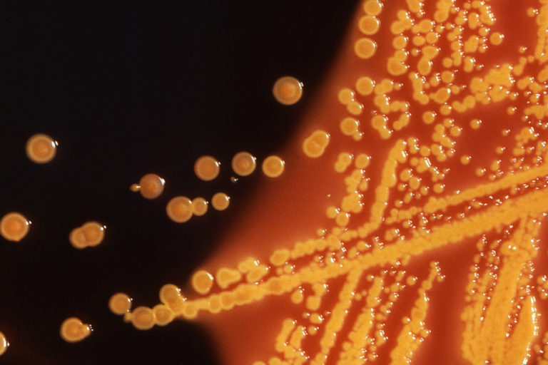 Perspectives on antibiotic resistance: how we got here, where we’re headed