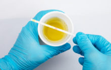 what can your doctor tell from your urine?