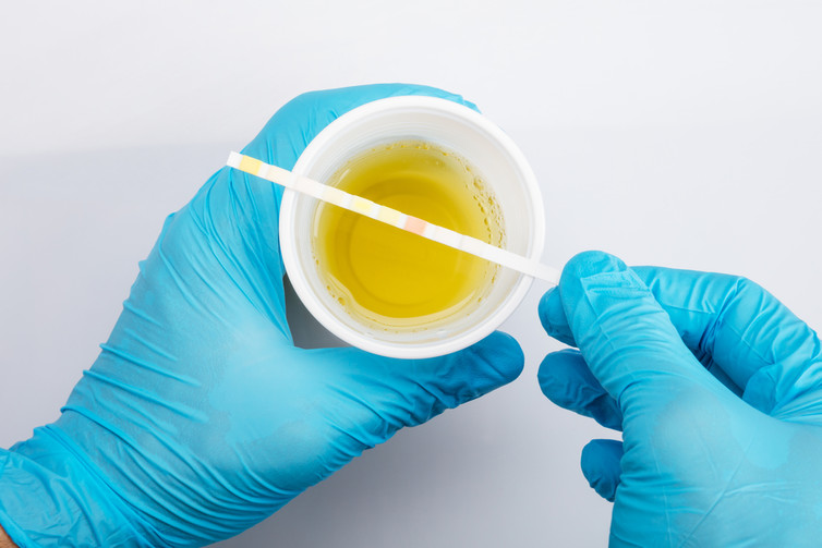 what can your doctor tell from your urine?