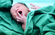 Increasing caesarean sections in Africa could save more mothers’ lives