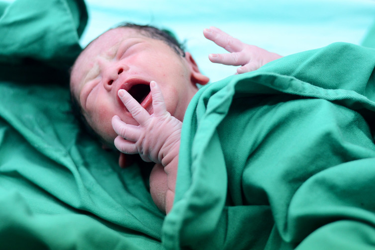 Increasing caesarean sections in Africa could save more mothers’ lives