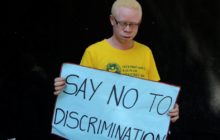 The trade in body parts of people with albinism is driven by myth and international inaction