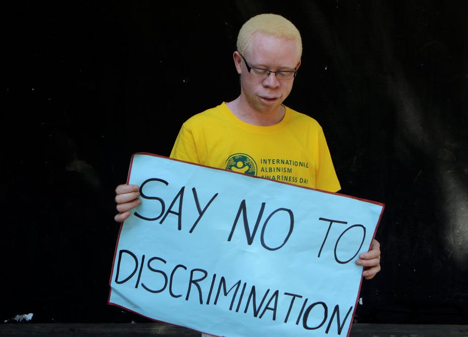 The trade in body parts of people with albinism is driven by myth and international inaction