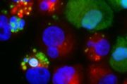 How ‘cannibalism’ by breast cancer cells promotes dormancy: A possible clue into cancer recurrence