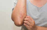 Common skin rashes and what to do about them
