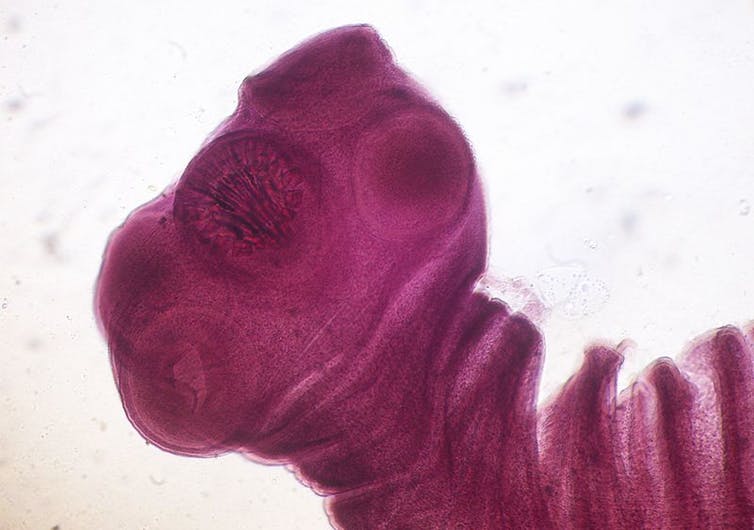 The top ten parasites that could be lurking in your food